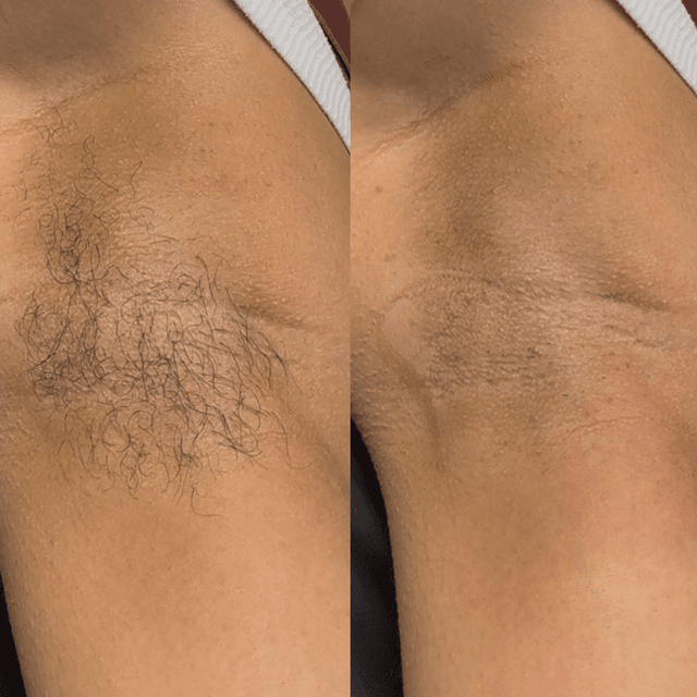Underarm 6 Pack at Deme’s Den in Dayton, OH